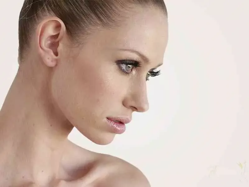 Rhinoplastie