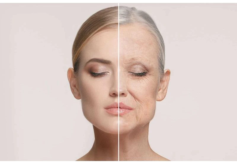 Lifting Cervico-Facial Deep Plane