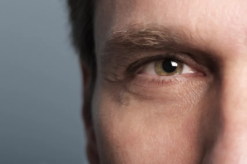 Blépharoplastie