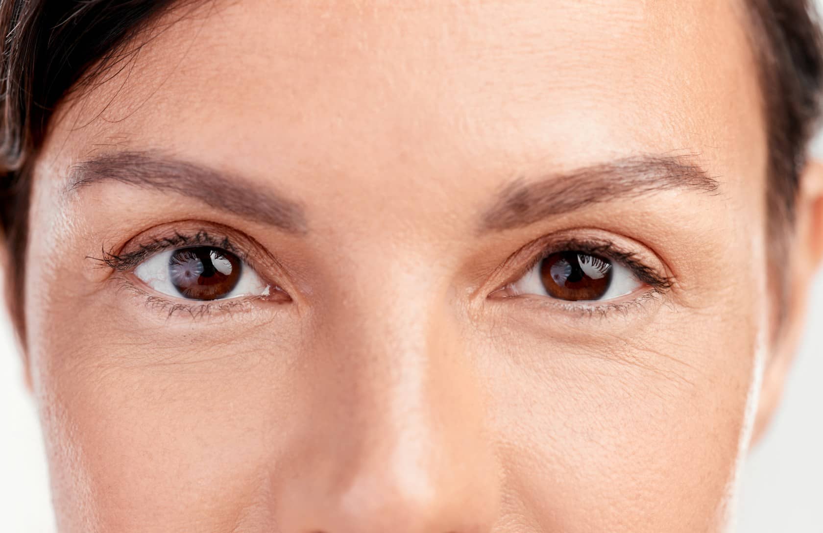 Blépharoplastie