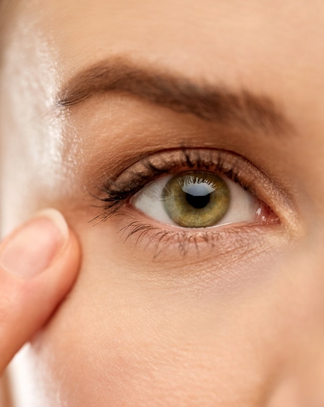 Blépharoplastie