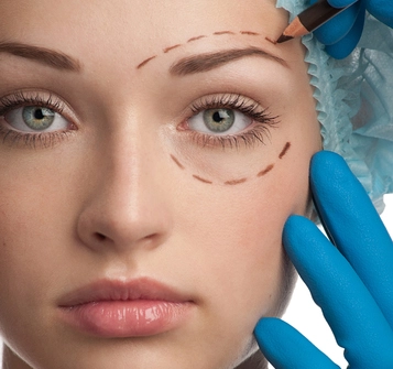 Lipofilling visage ( Microfat / Nanofat )