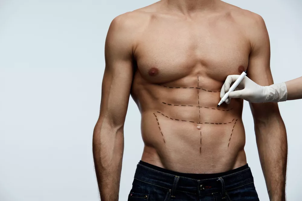 Chirurgie de l'homme