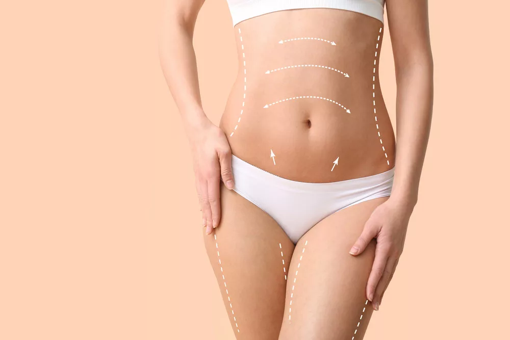 Chirurgie de la silhouette