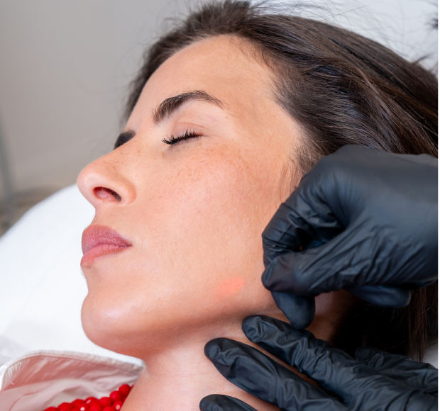 Endolift : Le lifting du visage sans chirurgie invasive
