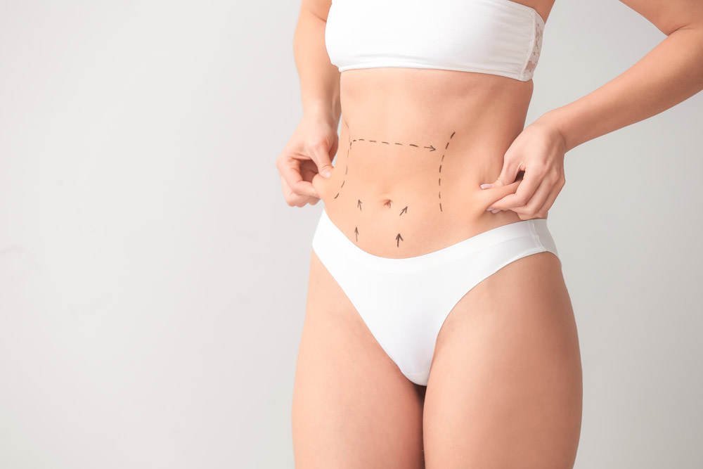 Mini-lift abdominal