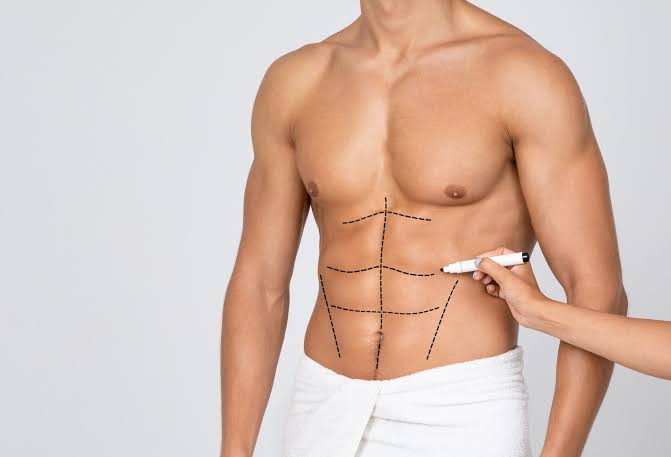 Liposculpture haute définition